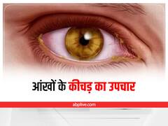 Eye Discharge: आंखों में जमा कीचड़ को इस तरह करें साफ