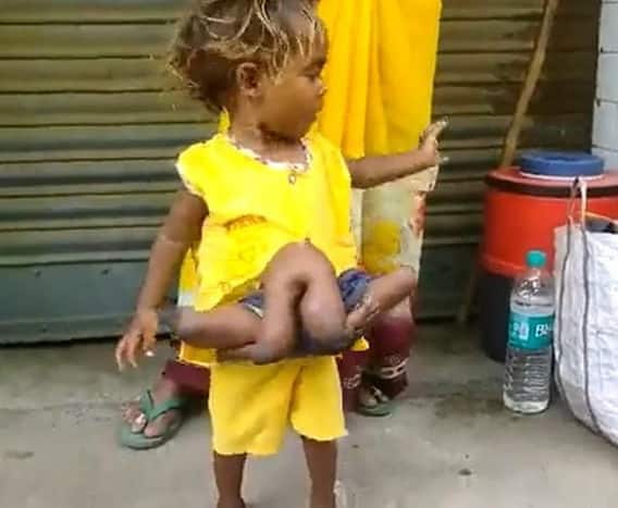 તમને જણાવી દઈએ કે, સોનુ સૂદે પોતે પોતાના ઈન્સ્ટાગ્રામ પર તે છોકરીના ફોટા શેર કરીને આ સમાચારની માહિતી આપી છે. ફોટો શેર કરતા તેણે લખ્યું- 'મારી અને ચૌમુખી કુમારીની સફર સફળ રહી. ચૌમુખીનો જન્મ બિહારના એક નાના ગામમાં ચાર પગ અને ચાર હાથ સાથે થયો હતો. હવે તે સફળ સર્જરી બાદ પોતાના ઘરે પરત જવા માટે તૈયાર છે.