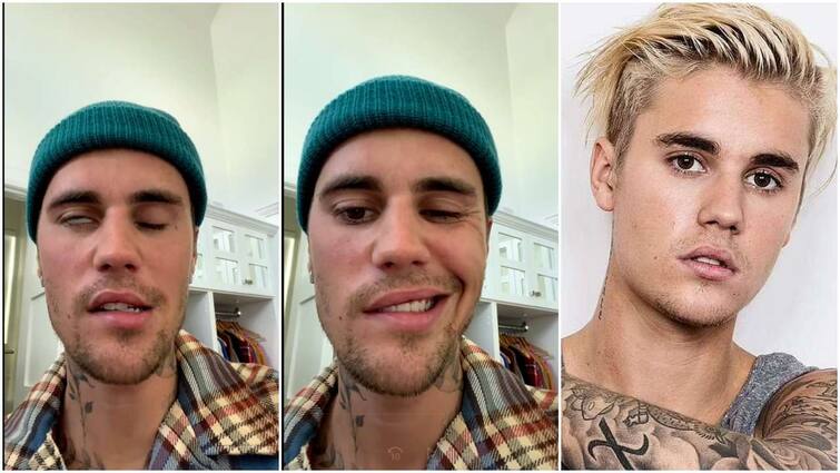 Justin Bieber suffering from partial face paralysis, cancels shows Justin Bieber ਦਾ ਅੱਧਾ ਚਿਹਰਾ ਹੋਇਆ ਪੈਰਾਲਾਈਜ਼, ਕਿਹਾ - ਮੈਂ ਅੱਖ ਵੀ ਨਹੀਂ ਝਪਕ ਪਾ ਰਿਹਾ