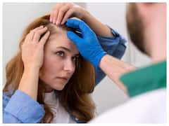 Hairfall से लेकर वजन को भी कंट्रोल करता है अश्वगंधा, जानें महिलाओं के लिए कितना फायदेमंद