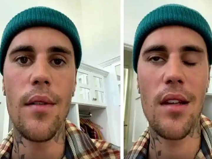 Justin Bieber का आधा चेहरा हो गया पैरालाइज, जानिए क्‍या होता है Ramsay Hunt Syndrome