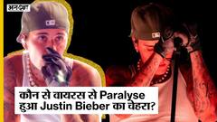 Justin Bieber का आधा चेहरा हुआ Paralyze, Concert Cancel होने से India Fans में फैली निराशा!