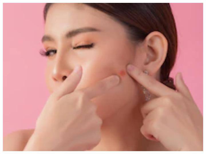 दाग धब्बों के निशान हल्के करने के लिए: नीम की 10 ताजी पत्तियों को गुलाबजल के साथ पीस लें और इसे मुल्तानी मिट्टी के साथ मिक्स करके लगाएं. अब इसे गोल गोल डायरेक्शन में मसाज करें और धोलें.