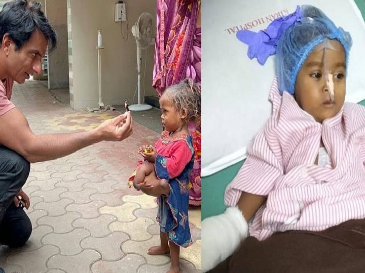 Sonu Sood Helps Child Who Was Born With 4 Legs and 4 Hands 4 கை, கால்களுடன் பிறந்த குழந்தை.. சரியான நேரத்தில் உதவிய நடிகர் சோனுசூட்..