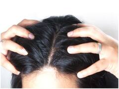 Health Tips: सिर की मालिश के हैं कई फायदे, थकान, तनाव और सिर दर्द हो जाएगा गायब