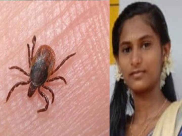 Scrub Typhus : அடுத்த அச்சுறுத்தல்.. 3 நாட்களில் இரண்டாவது மரணம்.. அதிரவைக்கும் ஸ்க்ரப் டைஃபஸ் தொற்று