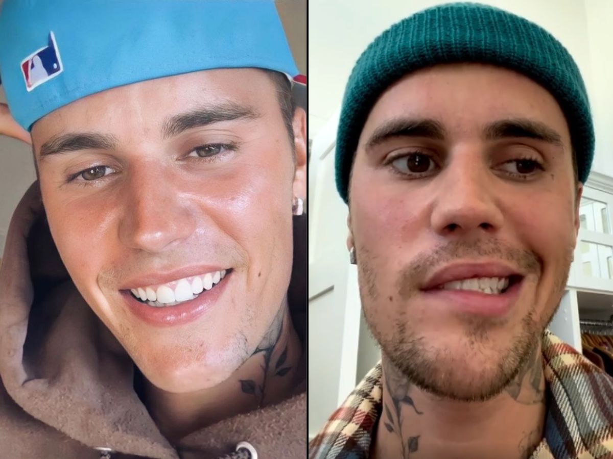 Justin Bieber diagnosed with Ramsay Hunt syndrome, says half his face is  paralyzed