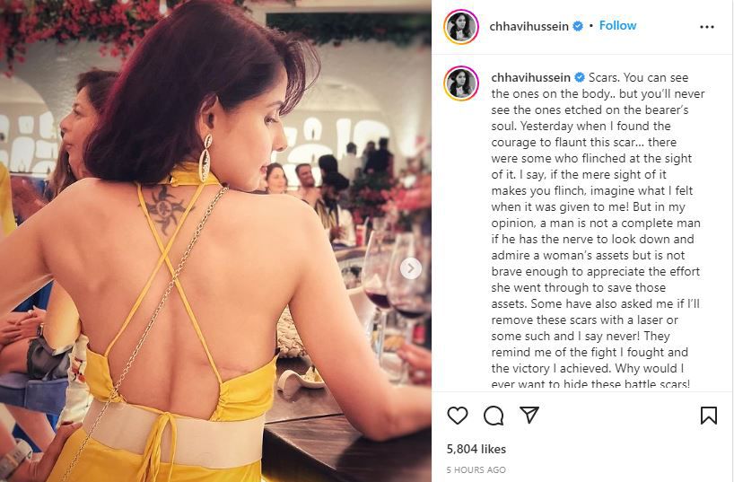 Chhavi Mittal: टीवी एक्ट्रेस छवि मित्तल ने शेयर किया कैंसर सर्जरी का फोटो, फैन्स ने दिए चौंकाने वाले रिएक्शन