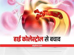 High Cholesterol: शरीर के इन हिस्सों में चुभन जैसा दर्द है हाई कोलस्ट्रोल की निशानी