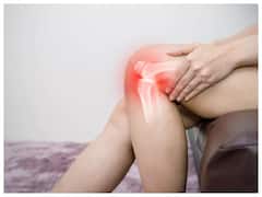 Arthritis Home Remedy: इन घरेलू नुस्खों से घर पर ही गठिया के दर्द में मिलेगा आराम