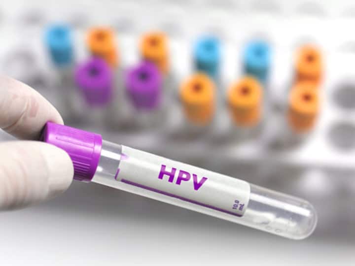 Serum Institute developed quadrivalent human papillomavirus vaccine for cervical cancer patients 9 to 26 years Govt Panel Gives Nod To Serum Institute's qHPV Vaccine For Cervical Cancer Patients Aged 9-26 Yrs