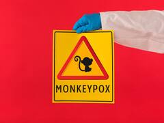 WHO To Change Name Of Monkeypox Virus To Tackle Stigma Associated With It: Report