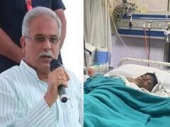 Chhattisgarh Rescue Operation: रेस्क्यू के बाद मेडिकल टीम की निगरानी में राहुल, आज अस्पताल में मिलने जाएंगे सीएम बघेल