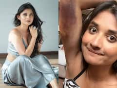 Khatron Ke Khiladi 12: टास्क के दौरान जख्मी हुईं कनिका मान, खतरों के खिलाड़ी के साथ से वायरल हुई तस्वीरें