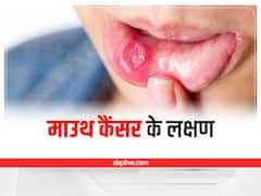 Health Tips: किसे है माउथ कैंसर का सबसे ज्यादा खतरा, जानिए ओरल कैंसर के लक्षण