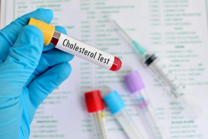 Health Tips: Recognize these symptoms without testing. Is cholesterol not rising in the body? Health Tips: ਬਗੈਰ ਟੈਸਟ ਕੀਤੇ ਇਨ੍ਹਾਂ ਲੱਛਣਾਂ ਤੋਂ ਪਛਾਣੋ ਕਿਤੇ ਸਰੀਰ 'ਚ ਕੋਲੈਸਟ੍ਰੋਲ ਤਾਂ ਨਹੀਂ ਵੱਧ ਰਿਹਾ?