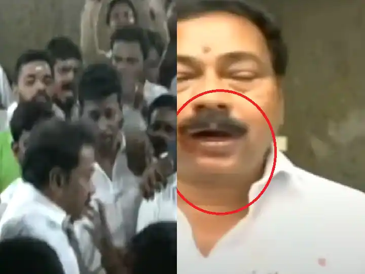 AIADMK Unitary Leadership Row: Party Functionary Suffers Injury During Clash At HQ AIADMK Unitary Leadership Row: Party Functionary Suffers Injury During Clash At HQ