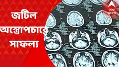 Rare Operation : কৃত্রিম ভাবে হার্ট ও ফুসফুস চালু রেখে স্ট্রোকে আক্রান্ত রোগিণীর হার্ট থেকে বাদ দেওয়া হল টিউমার