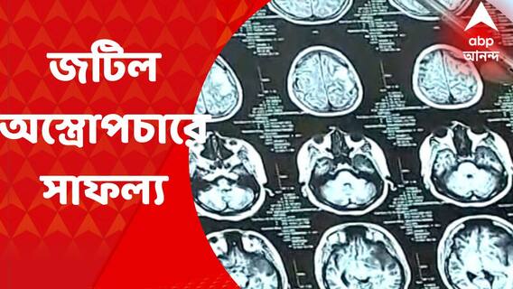 Rare Operation : কৃত্রিম ভাবে হার্ট ও ফুসফুস চালু রেখে স্ট্রোকে আক্রান্ত রোগিণীর হার্ট থেকে বাদ দেওয়া হল টিউমার