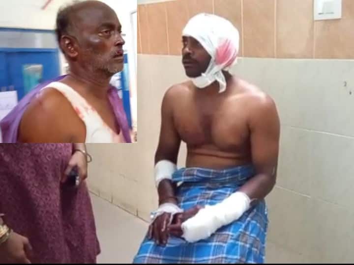 A Fruit Shop Owner Attacked neighbor Shop Persona In Srikakulam Crime News: పండ్ల షాపులో పాటల చిచ్చు- సౌండ్‌ తగ్గించమంటే చెవి కోసేశాడు