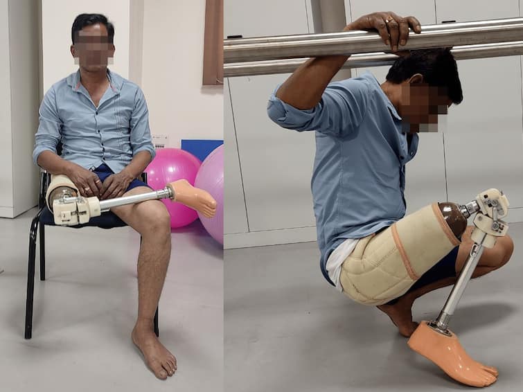 Prosthetic Leg Suitable For Indian Conditions Developed By IIT Guwahati Researchers Prosthetic Leg Suitable For Indian Conditions Developed By IIT Guwahati Researchers
