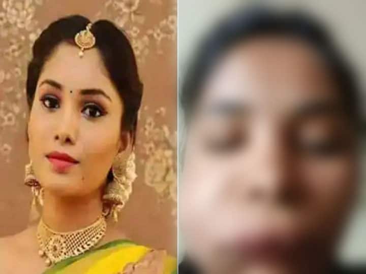 Kannada actress swathi sathish gets swollen face after wrong root canal surgery Swati Sathish Surgery: कन्नड़ एक्ट्रेस स्वाति सतीश को सर्जरी कराना पड़ा भारी, गलत सर्जरी से बिगड़ गया पूरा चेहरा