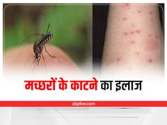 Mosquito Bite: मच्छर के काटने से हैं परेशान? इन घरेलू उपायों से करें बचाव