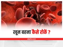 Stops Bleeding: फर्स्ट एड में नहीं है बैंडेज, इन घरेलू उपायों से तुरंत रोकें खून