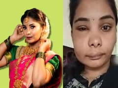 swathi Surgery: రూట్ కెనాల్ సర్జరీ ప్రమాదకరమా? ఆ నటి ముఖం ఎందుకలా మారిపోయింది?