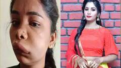 Then And Now: આ અભિનેત્રીઓને ચહેરા અને શરીરની સર્જરી કરાવવી ભારે પડી, કેટલીકે જીવ પણ ગુમાવ્યો