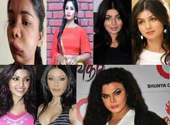 Then And Now: આ અભિનેત્રીઓને ચહેરા અને શરીરની સર્જરી કરાવવી ભારે પડી, કેટલીકે જીવ પણ ગુમાવ્યો