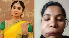 Celebs Wrong Surgery: सर्जरी कराना इन एक्ट्रेस को भी पड़ा भारी! किसी की हुई मौत तो किसी का बिगड़ गया चेहरा