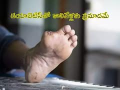 Diabetes: ఆ హీరో కాలివేళ్లు తొలగించడానికి కారణం డయాబెటిసే, ఈ పరిస్థితి రాకుండా జాగ్రత్త పడండి