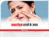 Whiteheads Remedies : स्किन की खूबसूरती बिगाड़ सकते हैं व्हाइटहेड्स, इन उपायों से करें दूर