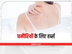 Heat Rash Herbs: चुभती घमौरियों की परेशानी दूर करने में असरदार हैं ये हर्ब्स