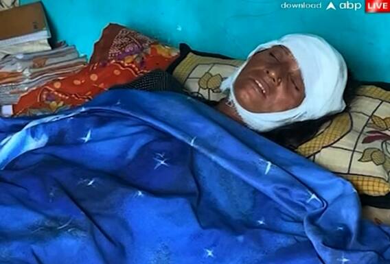 વડોદરાઃ રખડતા ઢોરે વધુ એક મહિલાને લીધી અડફેટે, માથાના ભાગે 9 ટાંકા આવ્યા