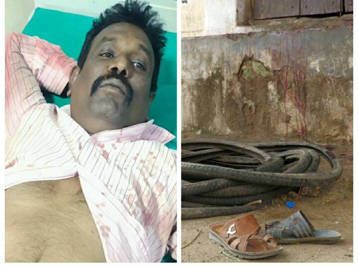 The son who barraged those who quarreled with his father in tirunelveli Crime : தந்தையோடு தகராறு செய்தவர்களை சரமாரியாக வெட்டிய மகன்! போலீஸ் வலைவீச்சு