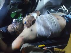 Bihar Crime: सीवान में सांसद के करीबी को बदमाशों ने मारी गोली, प्रॉपर्टी डीलिंग का करता था काम, लक्ष्मीपुर की घटना