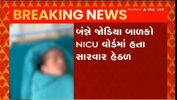 સુરત સિવિલમાં તરછોડાયેલા જોડિયા બાળકોમાંથી એકનું મોત
