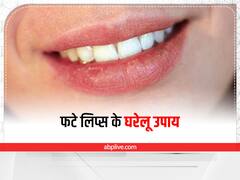 Chapped Lips : फटे होंठो से खराब हो सकती है आपकी खूबसूरती, इन उपायों से होंठों पर लाएं चमक