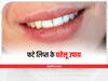 Chapped Lips : फटे होंठो से खराब हो सकती है आपकी खूबसूरती, इन उपायों से होंठों पर लाएं चमक