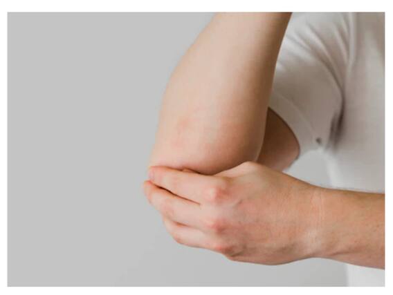 Dark Elbows : कोहनी का कालापन करना है दूर? आजमाएं ये असरदार नुस्खे Dark Elbows : कोहनी का कालापन करना है दूर? आजमाएं ये असरदार नुस्खे