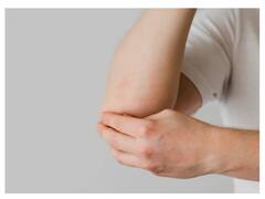 Dark Elbows : कोहनी का कालापन करना है दूर? आजमाएं ये असरदार नुस्खे