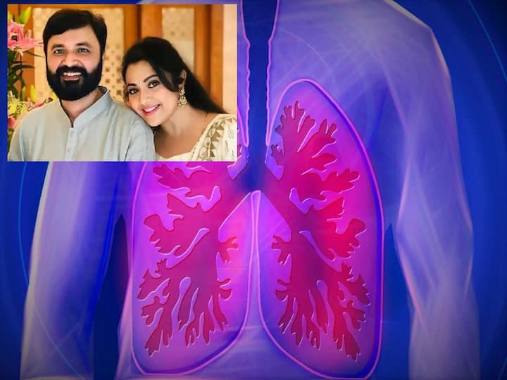 Meena's husband dies of lung infection, why does this infection occur? Can Transplantation Happen? Meena Husband Lung Infection:  ఊపిరితిత్తుల ఇన్ఫెక్షన్‌తో  మీనా భర్త మరణం , ఈ ఇన్ఫెక్షన్ ఎందుకు వస్తుంది? ట్రాన్స్‌ప్లాంటేషన్ కుదురుతుందా?