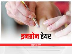 Ingrown Hair: स्किन दिखेगी एकदम स्मूद, इंग्रोन हेयर से नहीं होगी कोई परेशानी ये टिप्स अपनाएं
