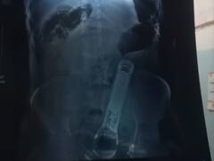 OMG! बर्थडे पर डांस नहीं किया तो प्राइवेट पार्ट में डाल दिया टॉर्च, बिहार की घटना जानकर कहेंगे कोई ऐसा भी करता है क्या