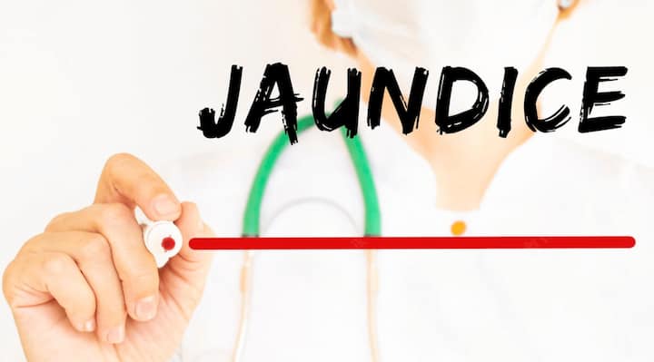 पीलिया रोगियों को जलेबी का सेवन करने की सलाह दी जाती है. इससे पीलिया में होने वाली परेशानियों को कम किया जा सकता है. (Photo - Freepik)