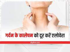 Skin Care Tips: काली गर्दन से हैं परेशान तो यूज करें एलोवेरा, जल्द दूर होगी परेशानी