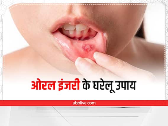 Oral Injury: जीभ या होंठ कटने पर तुरंत आजमाएं ये घरेलू उपाय, झट से मिलेगा आराम Oral Injury: जीभ या होंठ कटने पर तुरंत आजमाएं ये घरेलू उपाय, झट से मिलेगा आराम