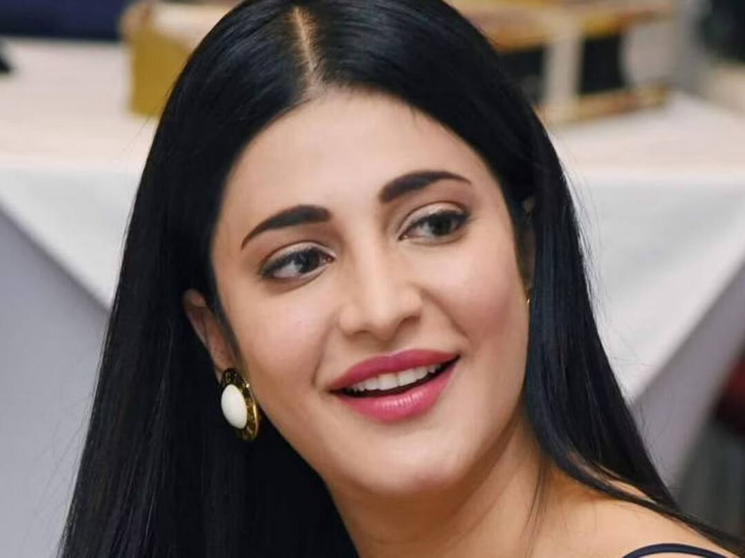 Shruti Haasan, who suffers from that health problem, is an actress who seems to be brave though Shruthi Haasan: ఆ ఆరోగ్యసమస్యతో బాధపడుతున్న శ్రుతి హాసన్, అయినా ధైర్యంగా ఉన్నానంటున్న నటి